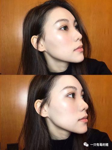 整过颧骨的明星,整过颧骨的明星风采大揭秘